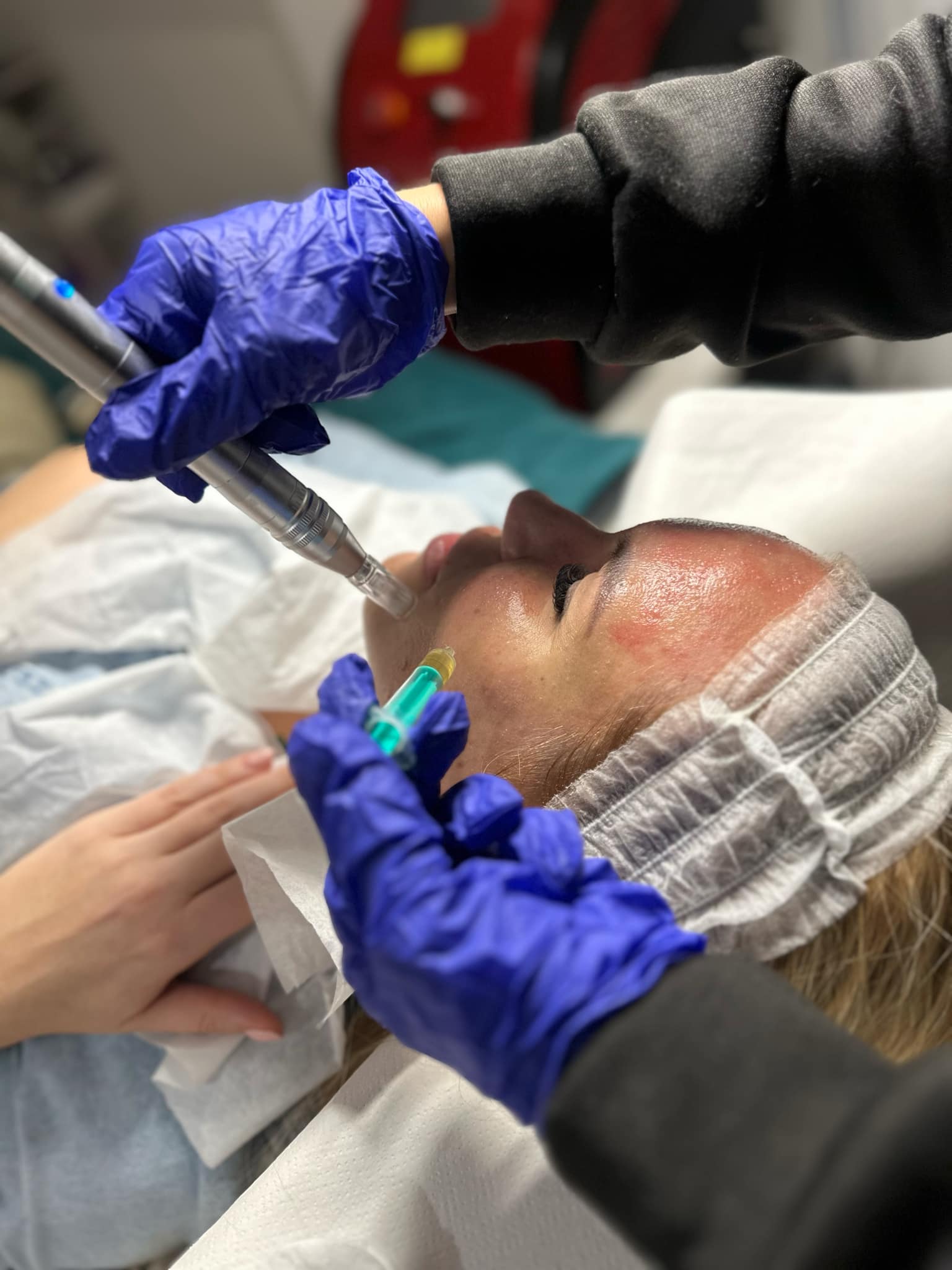 prp mosonyi beauty 4