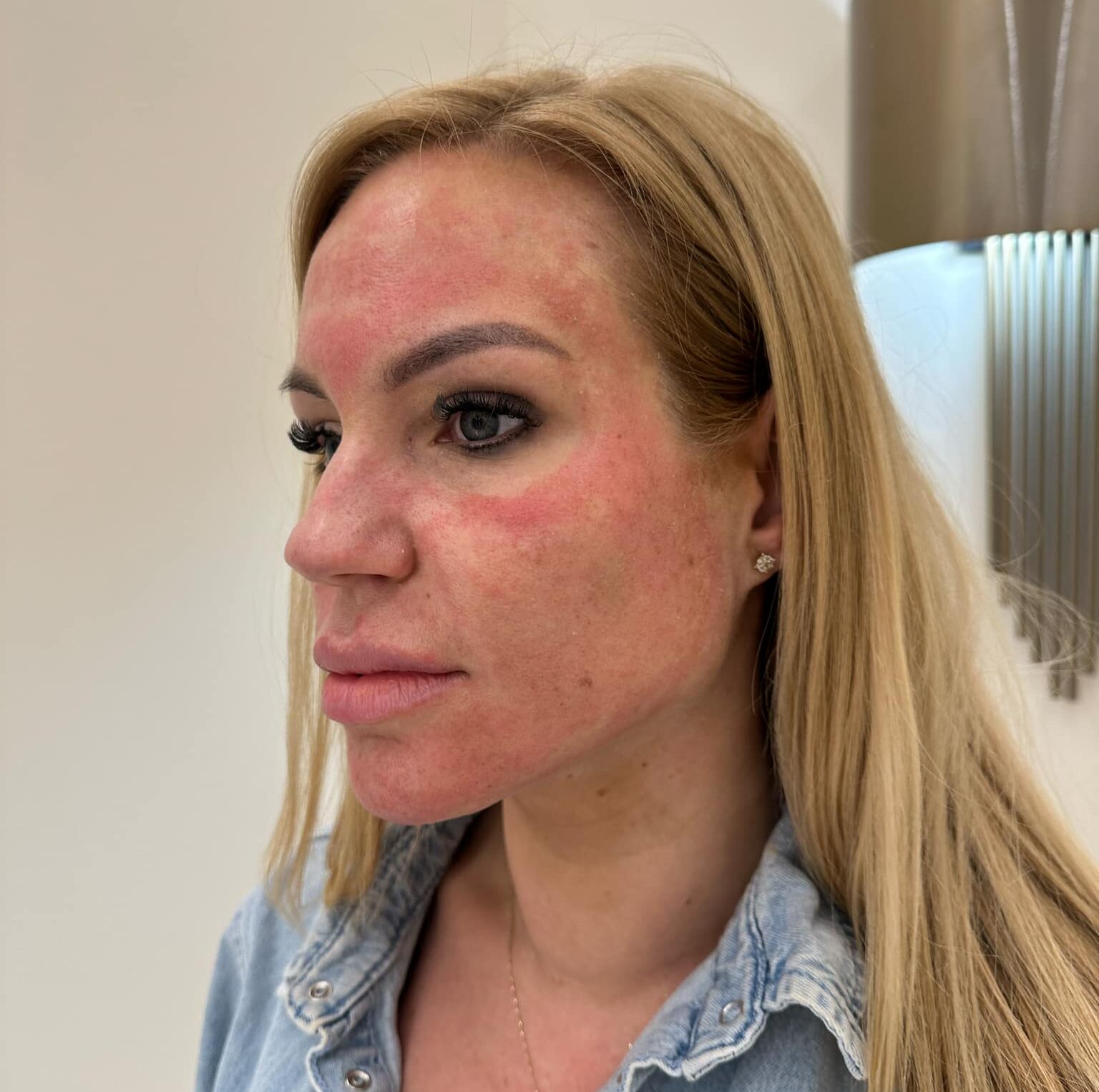 prp mosonyi beauty 5 e1732617251241