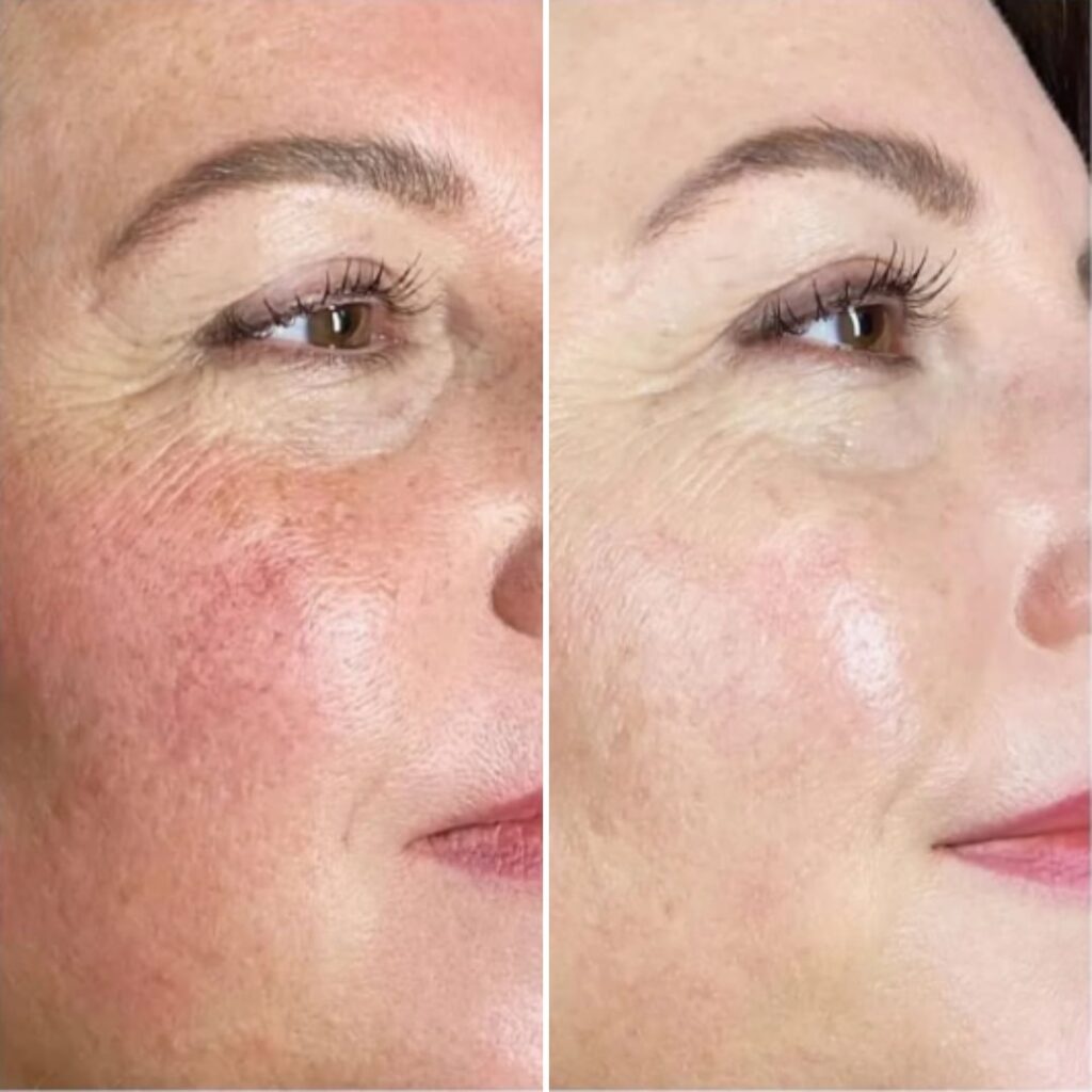 exosome terapia elotte utana (4)