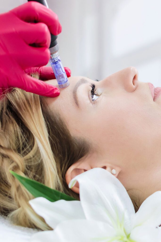 mezoterapias kezeles