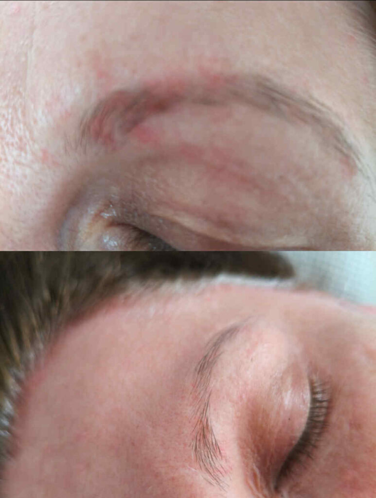 hidegplazma mosonyi beauty