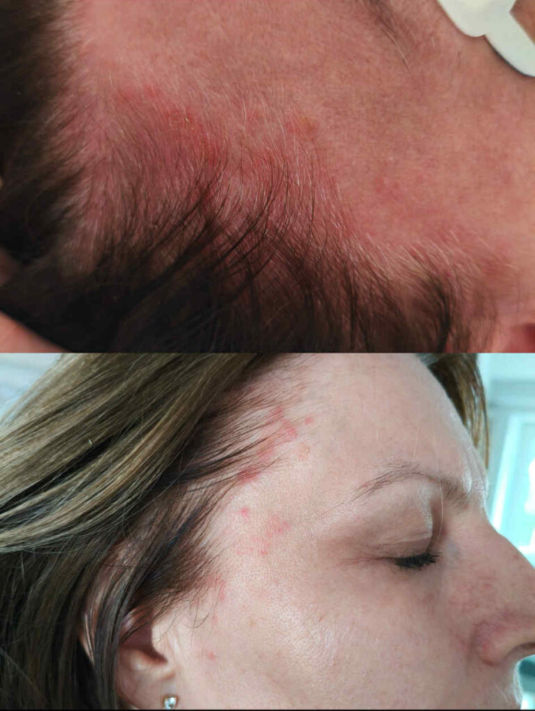 hidegplazma mosonyi beauty