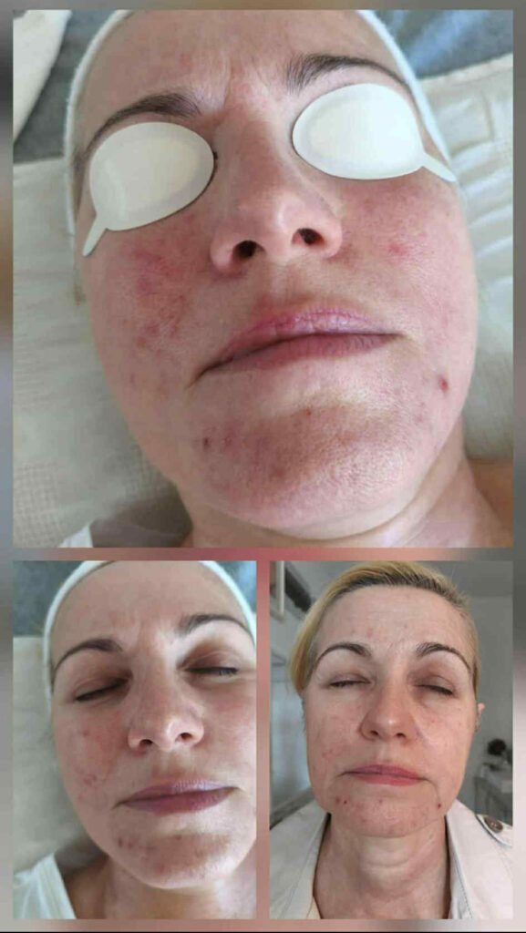 hidegplazma mosonyi beauty