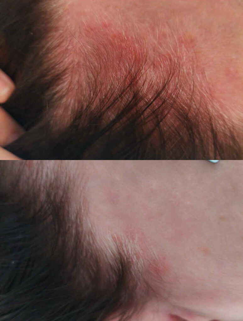 hidegplazma mosonyi beauty